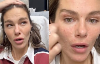 Maripier Morin montre toutes les images après son traitement