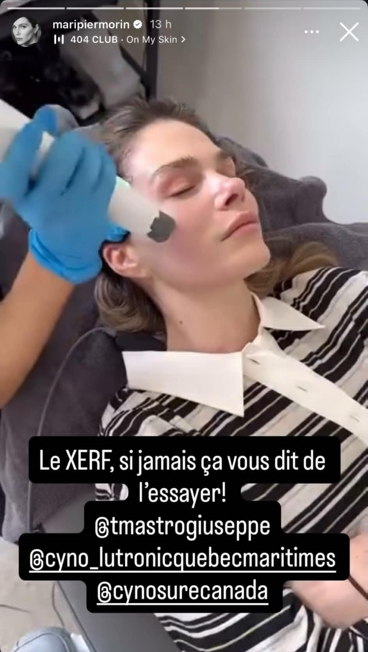 Traitement Xerf