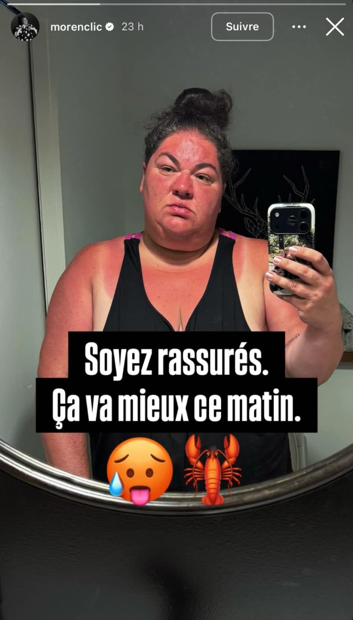 Coup de soleil